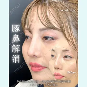 eクリニック 福岡院 伊藤 渉医師の症例