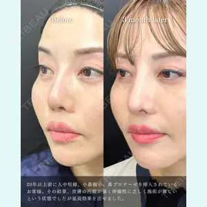 eクリニック 福岡院 伊藤 渉医師の症例