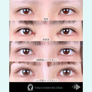 東京シンデレラ美容外科 池袋院 石井 達也医師の症例