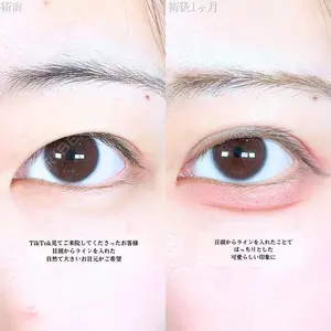 アリエル美容クリニック 大宮院 鈴木　桂介医師の症例