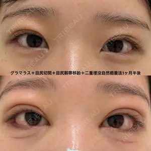 エターナル美容クリニック 久門田 詳医師の症例