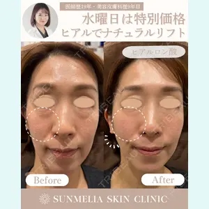 SUNMELIA SKIN CLINIC 遠山章子医師の症例