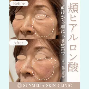 SUNMELIA SKIN CLINIC 遠山章子医師の症例
