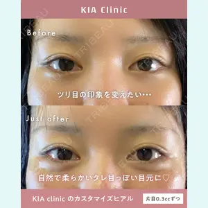 KIA CLINIC 心斎橋院 雲山　盛秀医師の症例