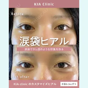 KIA CLINIC 心斎橋院 雲山　盛秀医師の症例