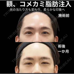 下北沢スキンクリニック 保坂 宗孝医師の症例