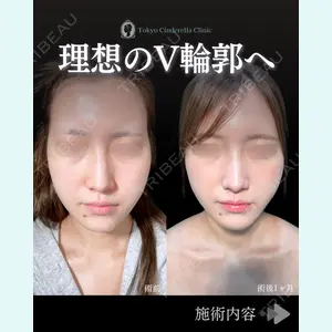 東京シンデレラ美容外科 池袋院 石井 達也医師の症例