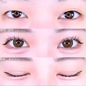 アリエル美容クリニック 水戸院 天白 典秀医師の症例