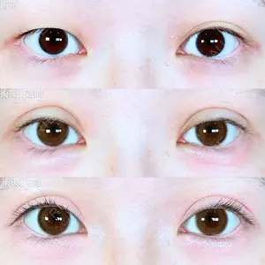 アリエル美容クリニック 大宮院 江郷隼一郎医師の症例