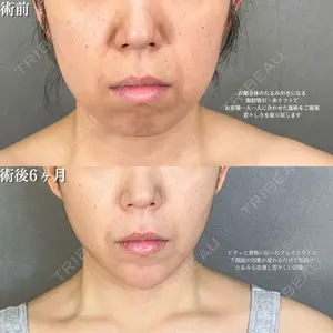 アリエル美容クリニック 大宮院 鈴木　桂介医師の症例