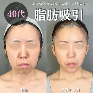 アリエル美容クリニック 大宮院 鈴木　桂介医師の症例