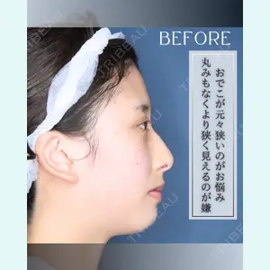 小倉美容外科/美容皮膚科 ビラビューティークリニック 大村 亞蘭医師の症例