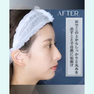 小倉美容外科/美容皮膚科 ビラビューティークリニック 大村 亞蘭医師の症例