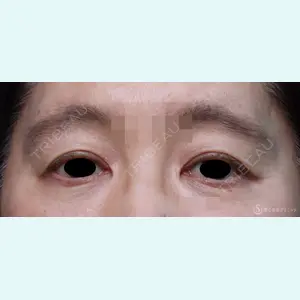 聖心美容クリニック 横浜院 佐々木 直美医師の症例