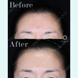 東京形成美容外科 船橋院 山崎 修吾医師の症例