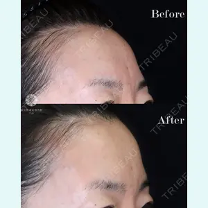 東京形成美容外科 船橋院 山崎 修吾医師の症例