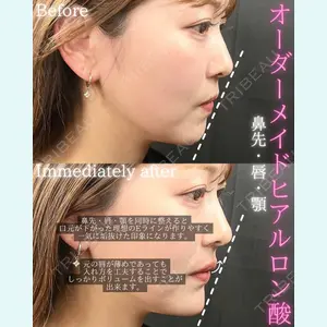 THE FIRST CLINIC 町田院 木暮 啓一郎医師の症例