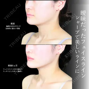 アリエル美容クリニック 大宮院 鈴木　桂介医師の症例