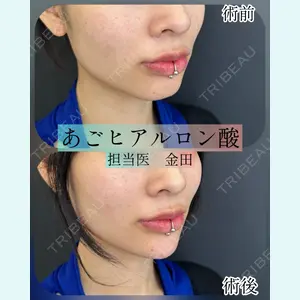 ルラ美容クリニック 横浜院 金田 成美医師の症例