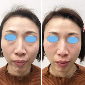 しのぶ皮膚科 蘇原しのぶ医師の症例