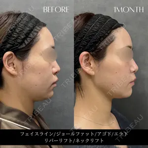 RIVER CLINIC（リバークリニック）大阪院の症例