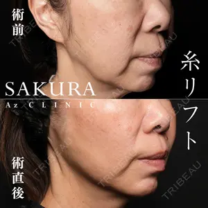 サクラアズクリニック 心斎橋院の症例
