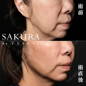 サクラアズクリニック 心斎橋院の症例