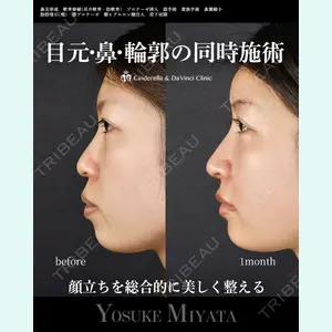 シンデレラ＆ダヴィンチクリニック 宮田 洋佑医師の症例