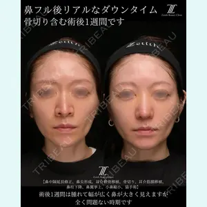 Zetith Beauty Clinic 銀座院 楠本 拓哉医師の症例