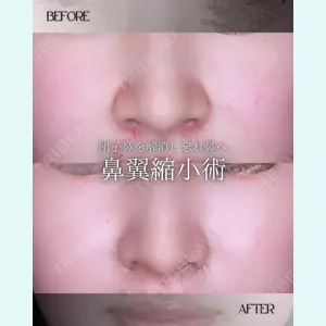 小倉美容外科/美容皮膚科 ビラビューティークリニック 大村 亞蘭医師の症例