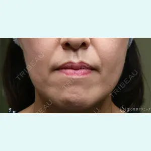 聖心美容クリニック 名古屋院 加藤 大典医師の症例