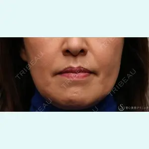 聖心美容クリニック 名古屋院 加藤 大典医師の症例