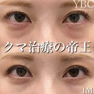 YBC横浜美容外科 大宮院 磯村 亮輔医師の症例