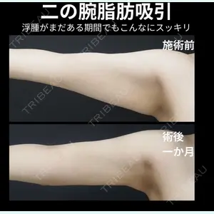 下北沢スキンクリニック 保坂 宗孝医師の症例