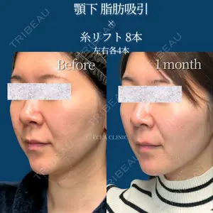ECLA CLINIC (エクラクリニック) 緒方 善孝医師の症例