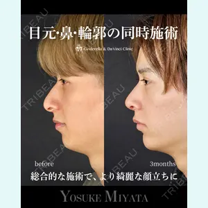 シンデレラ＆ダヴィンチクリニック 宮田 洋佑医師の症例