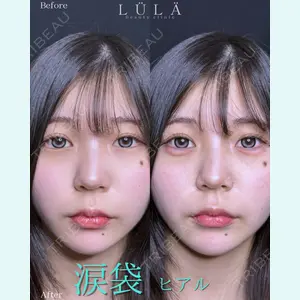 ルラ美容クリニック 町田院 松岡 舟作医師の症例