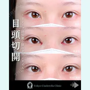 東京シンデレラ美容外科 池袋院 石井 達也医師の症例