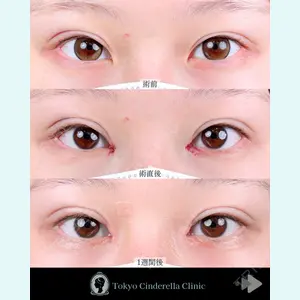 東京シンデレラ美容外科 池袋院 石井 達也医師の症例