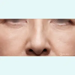 聖心美容クリニック 名古屋院 加藤 大典医師の症例