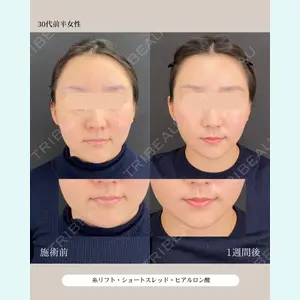 自由が丘ウェルエイジングビューティークリニック 福田 知佐子医師の症例