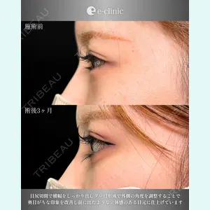 eクリニック 大阪院 八木 良太医師の症例