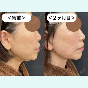 CHARIS BEAUTY CLINIC 木畑智哲医師の症例