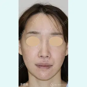 聖心美容クリニック 銀座院 牧野 陽二郎医師の症例
