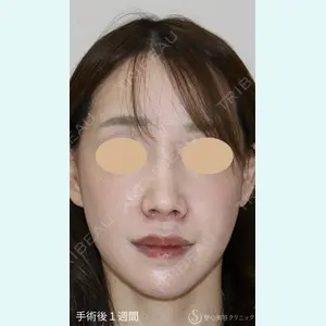 聖心美容クリニック 銀座院 牧野 陽二郎医師の症例