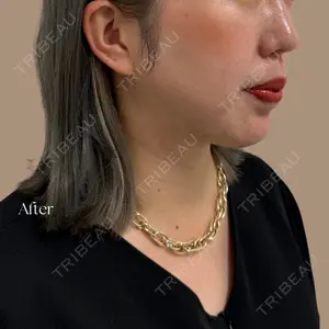 UNI CLINIC 大嶋 恭輔医師の症例