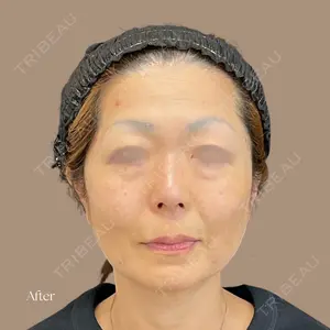 UNI CLINIC 大嶋 恭輔医師の症例