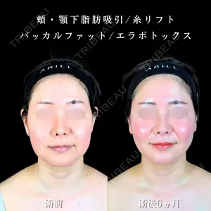 アリエル美容クリニック 大宮院 江郷隼一郎医師の症例