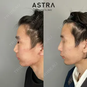ASTRA BEAUTY CLINIC 塩満 惠子医師の症例