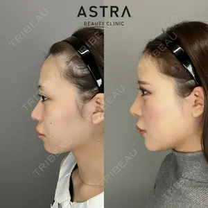 ASTRA BEAUTY CLINIC 塩満 惠子医師の症例